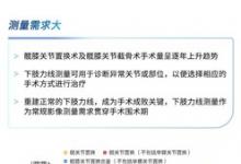 天津醫(yī)院放射科與聯(lián)影智能合作開發(fā)人工智能下肢力線測(cè)量系統(tǒng)