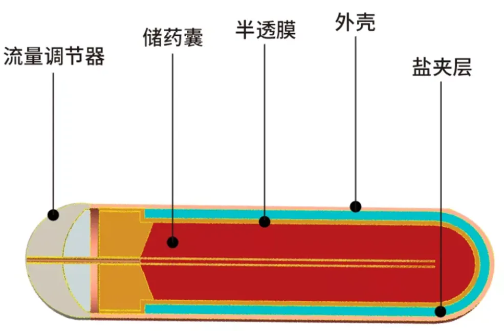 友思特方案 | 藥品無憂：機(jī)器視覺技術(shù)助力醫(yī)藥植入式緩釋泵直徑自動化測量