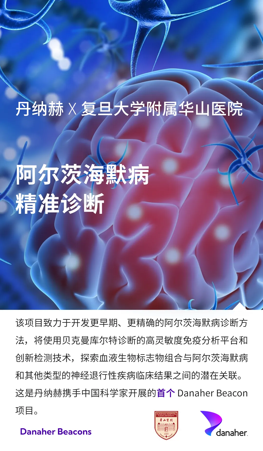 Danaher Beacon｜丹納赫集團與復旦大學附屬華山醫(yī)院合作開發(fā)阿爾茨海默病診斷新技術