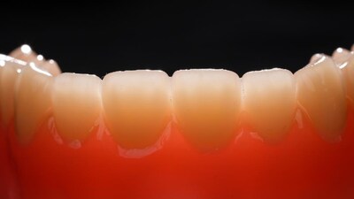多材料一體打印活動義齒