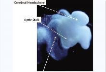 美科學(xué)家宣稱 培育出了第一個(gè)幾乎完全成型的人類大腦